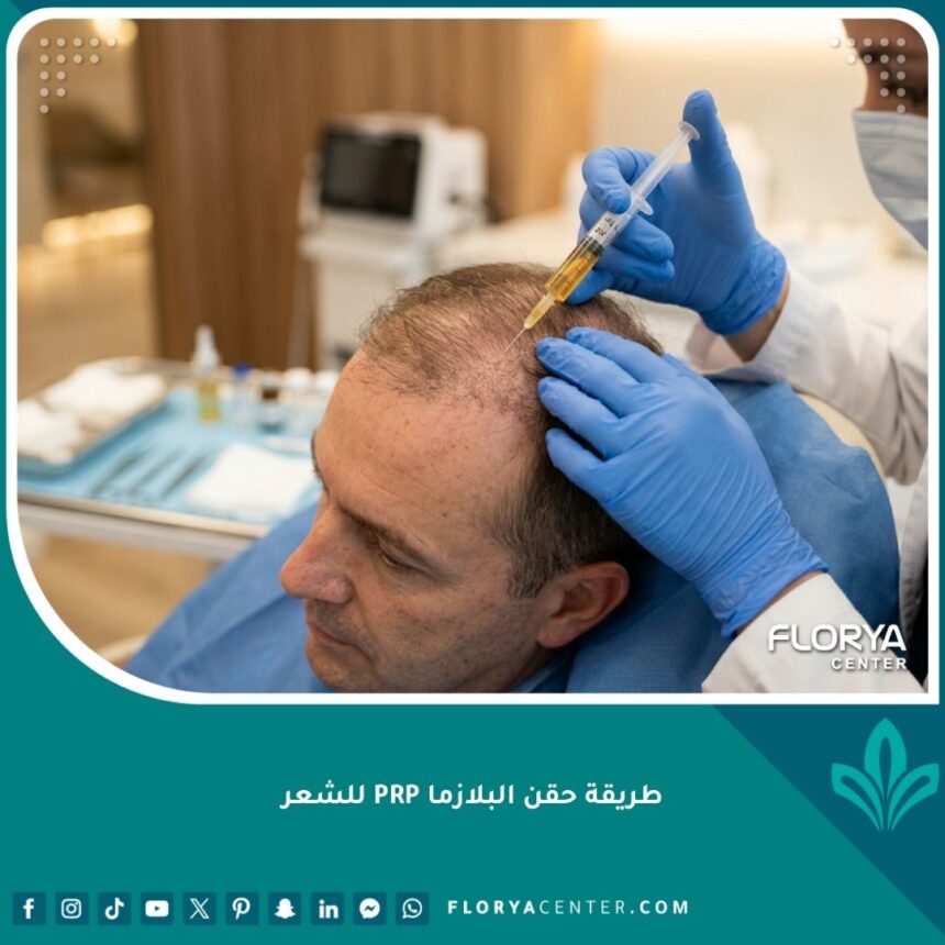 صورة بارزة احترافية توضح عملية حقن البلازما الغنية بالصفائح الدموية (PRP) في فروة الرأس لتقوية البصيلات.