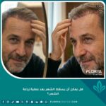 رجل ينظر في المرآة ويتحسس خط الشعر الأمامي بعد عملية زراعة الشعر، مظهر طبيعي لمرحلة النمو وظاهرة تساقط الشعر المؤقت.