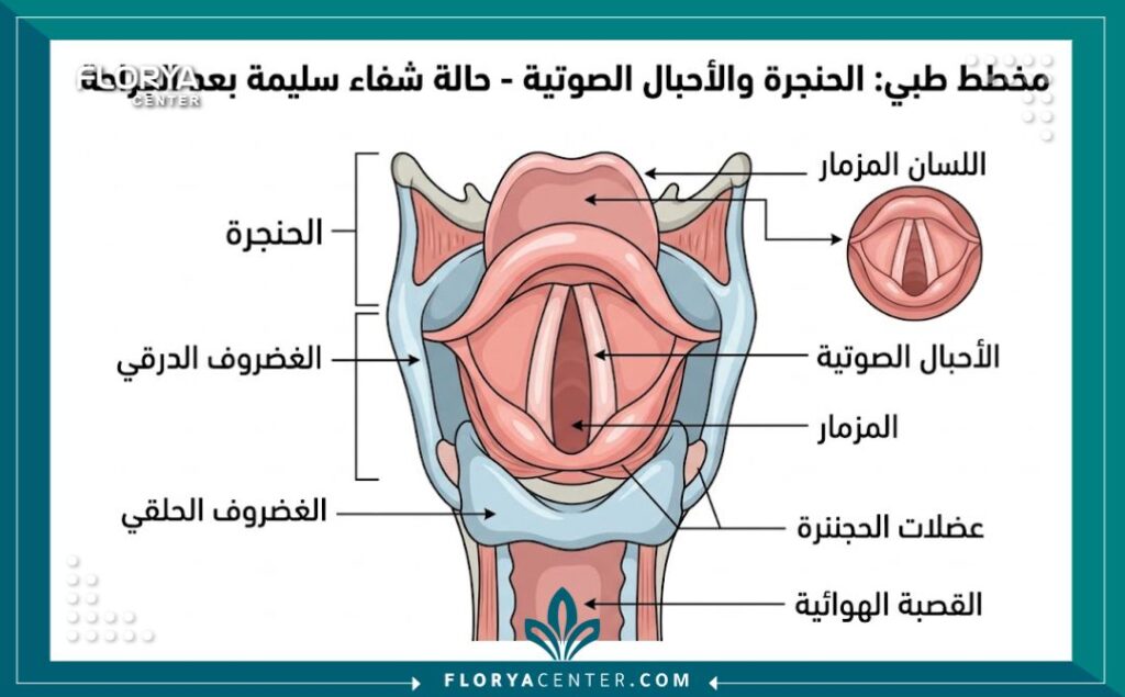 رسم تخطيطي طبي يوضح تشريح الحنجرة والأوتار الصوتية بعد العملية الجراحية لفهم كيفية تطبيق تمارين الصوت.