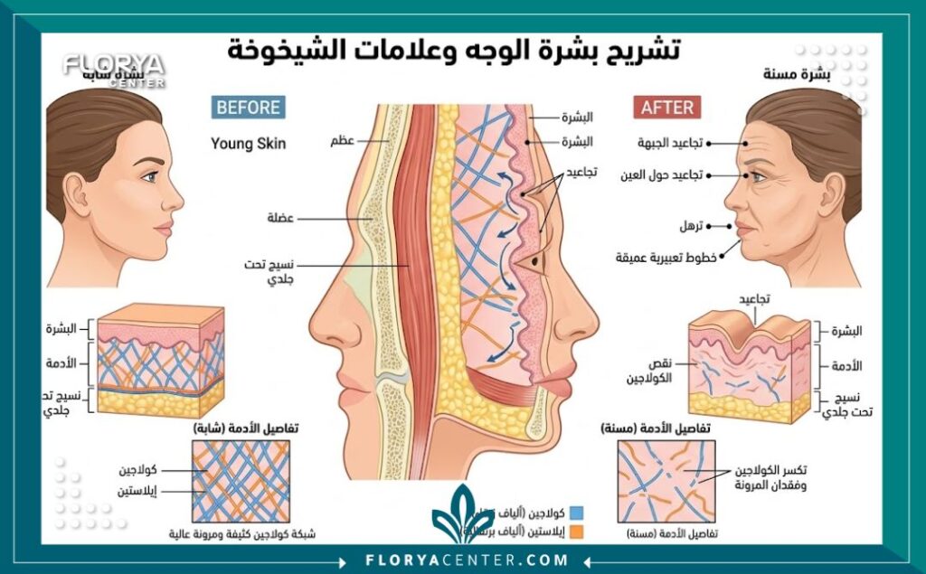 مخطط طبي يوضح طبقات الجلد ومناطق تشكل تجاعيد الوجه وعلامات تقدم السن.