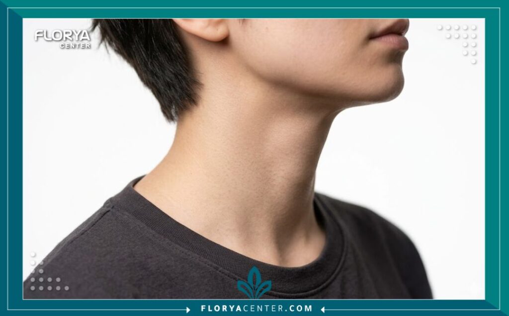 لقطة مقربة تجميلية تظهر مظهر الرقبة الناعم والمنحوت بعد عملية تصغير تفاحة آدم في تركيا.