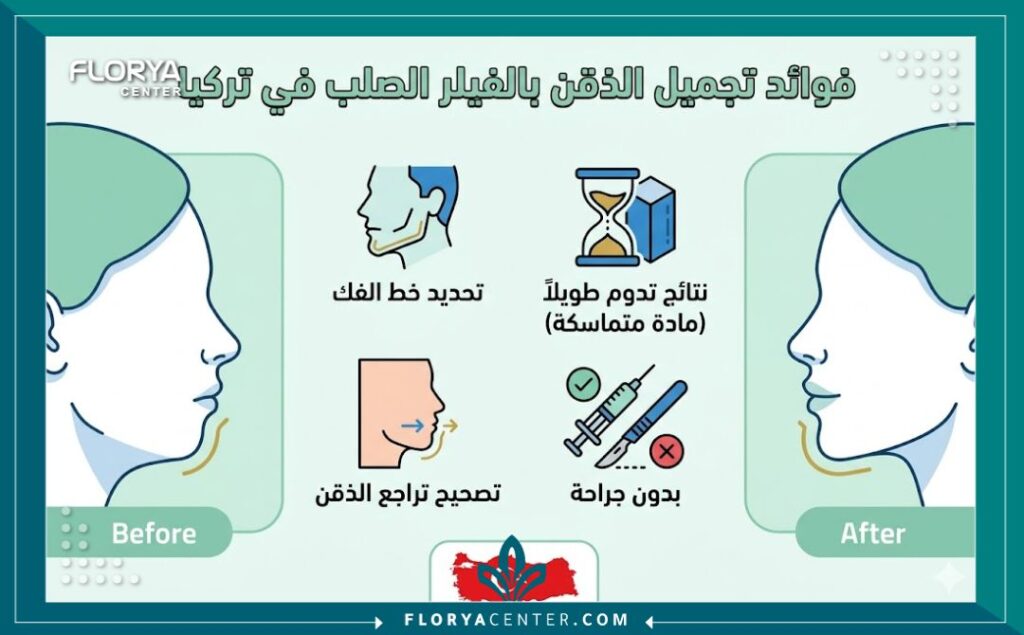 إنفوجرافيك يوضح مقارنة قبل وبعد حقن الذقن بالفيلر الصلب، مبرزاً فوائد تحديد الفك والحصول على مظهر V-shape بدون جراحة في تركيا.