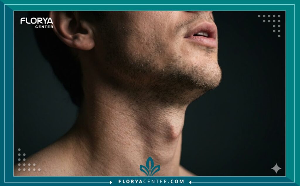 لقطة قريبة جمالية تبرز منطقة الحنجرة والرقبة لرجل بعد نجاح عملية تجميل الصوت الناعم في تركيا.