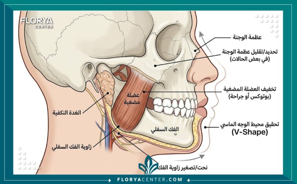 رسم توضيحي تشريحي للمناطق المستهدفة في نحت الفك والخدود للوجه الماسي
