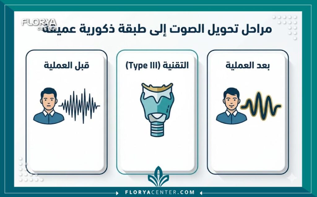 إنفوجرافيك يوضح الفرق في طبقة الصوت قبل وبعد عملية تخشين الصوت للرجال (Thyroplasty) في تركيا.