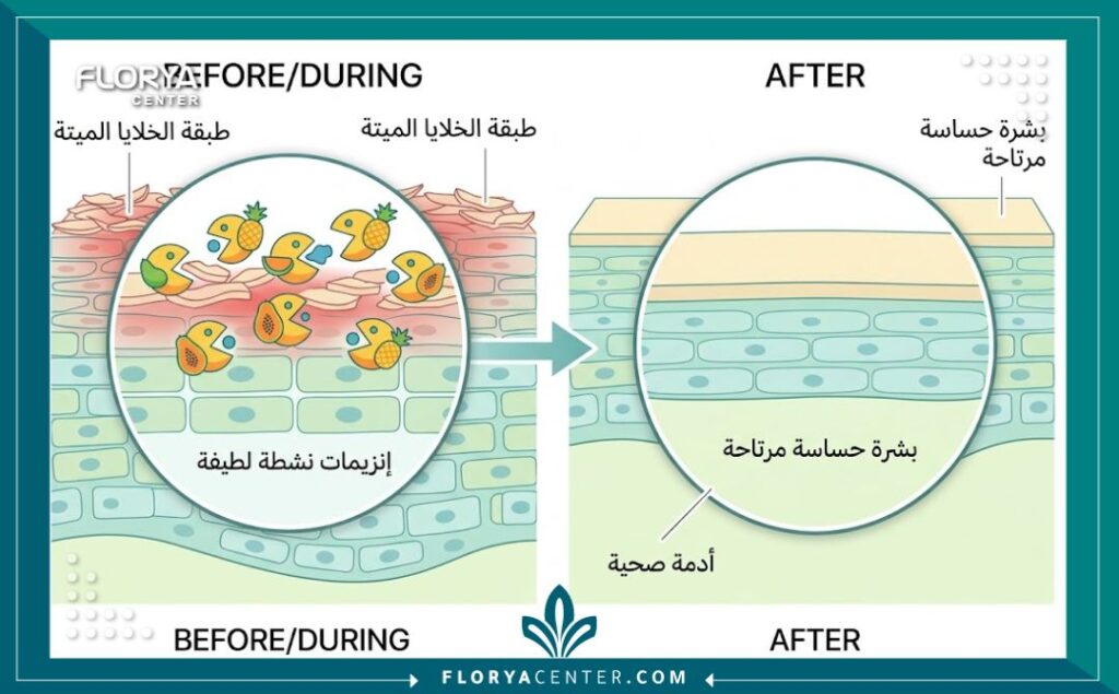 رسم توضيحي طبي يوضح آلية عمل إنزيمات الفاكهة في إذابة الخلايا الميتة بلطف على سطح البشرة الحساسة دون تهييجها.
