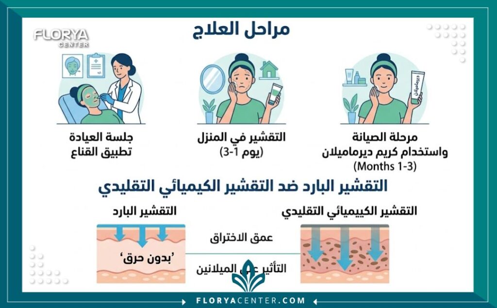 إنفوجرافيك تعليمي باللغة العربية يوضح مراحل علاج الكلف تقنية التقشير البارد في تركيا (كوزميلان)، من الجلسة الأولى في العيادة وحتى مرحلة العناية المنزلية بالكريمات.