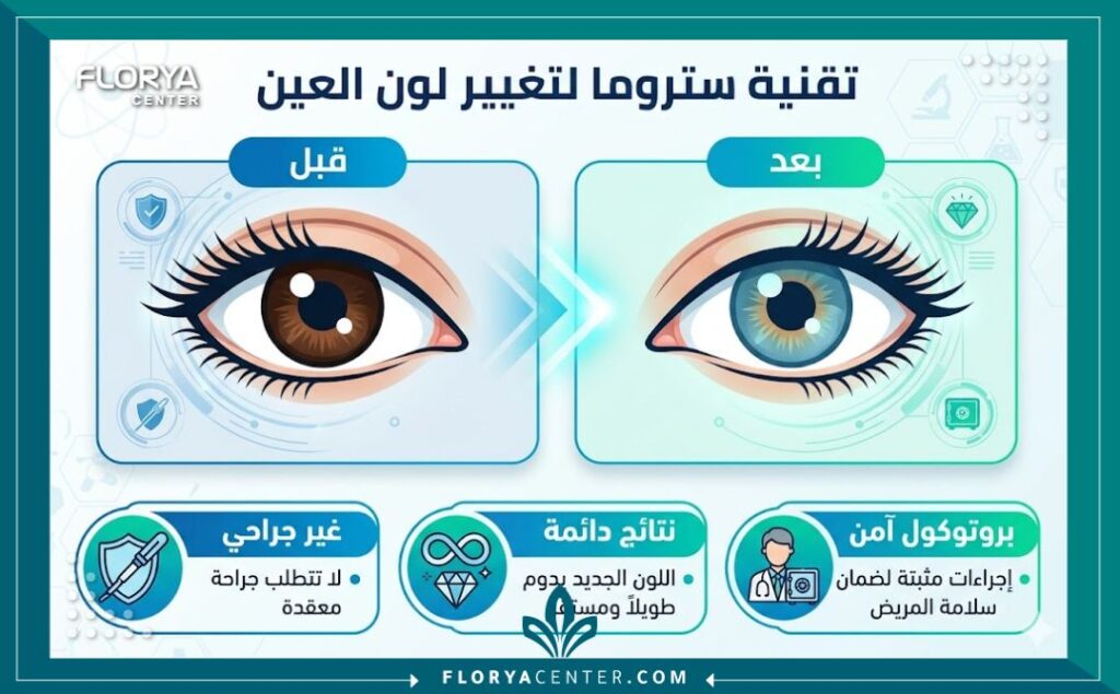 إنفوجرافيك يوضح مقارنة قبل وبعد استخدام تقنية ستروما لتغيير لون العين، ومميزات الإجراء مكتوبة باللغة العربية.
