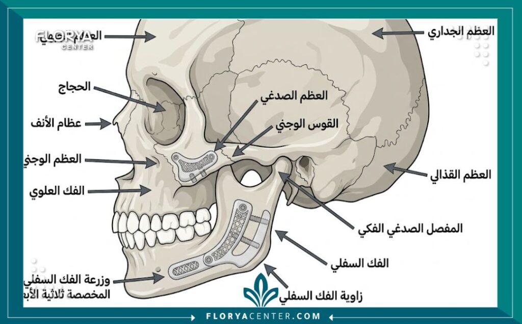 رسم توضيحي طبي دقيق يوضح تشريح الجمجمة وأماكن تثبيت غرسات الفك والوجنتين المصممة والمطبوعة بتقنية ثلاثية الأبعاد.