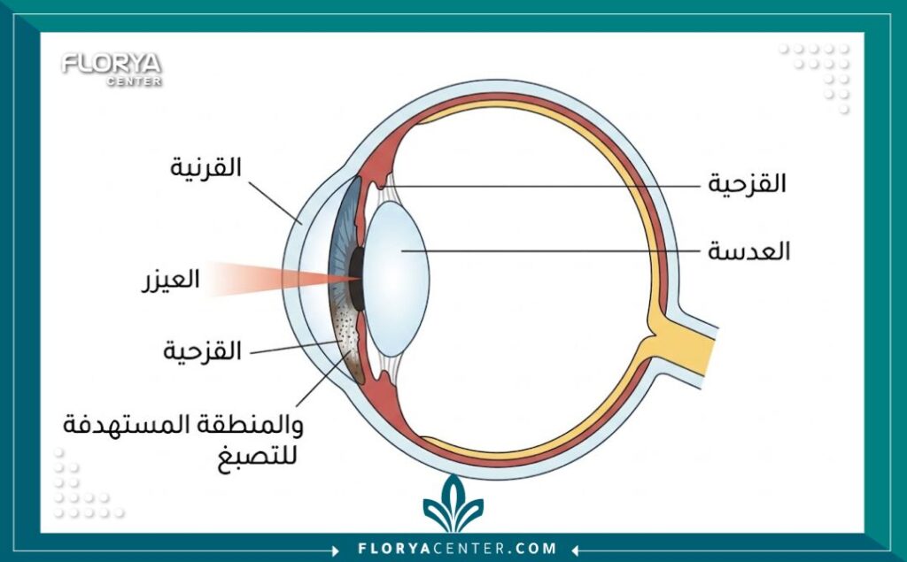 رسم تخطيطي طبي يوضح تشريح العين وكيفية إجراء عملية تغيير لون العين ليزر في تركيا.