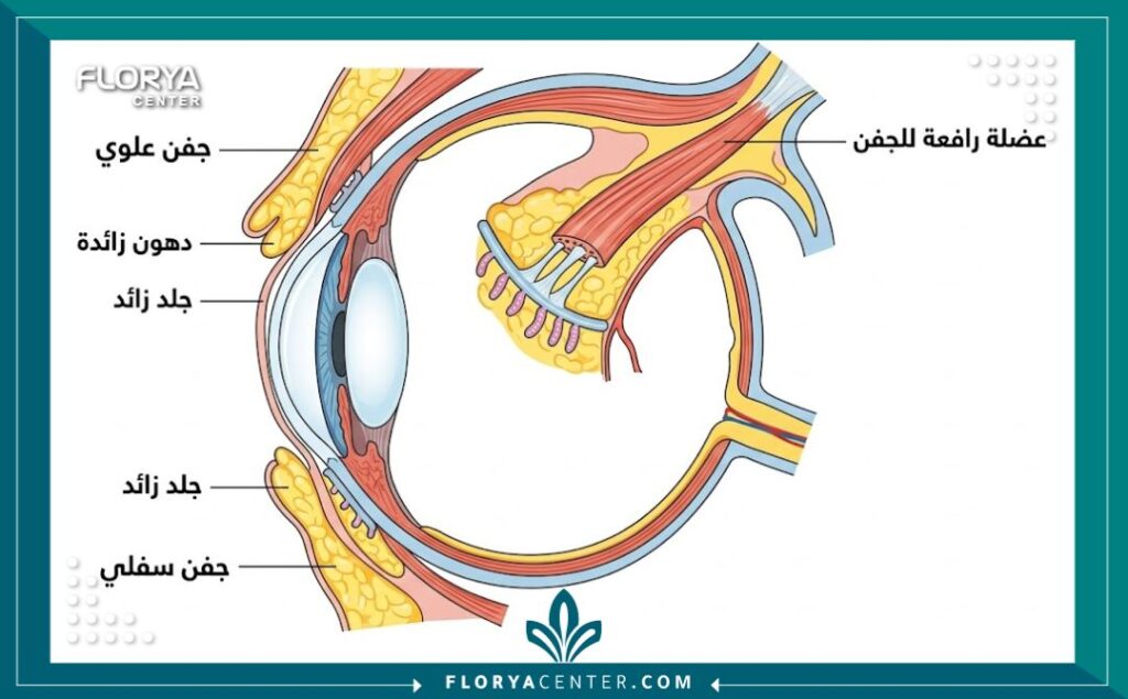 مخطط طبي تشريحي يوضح بنية العين والجفون العلوية والسفلية، مع إشارة إلى الدهون والجلد الزائد المستهدف في عملية شد الجفون.