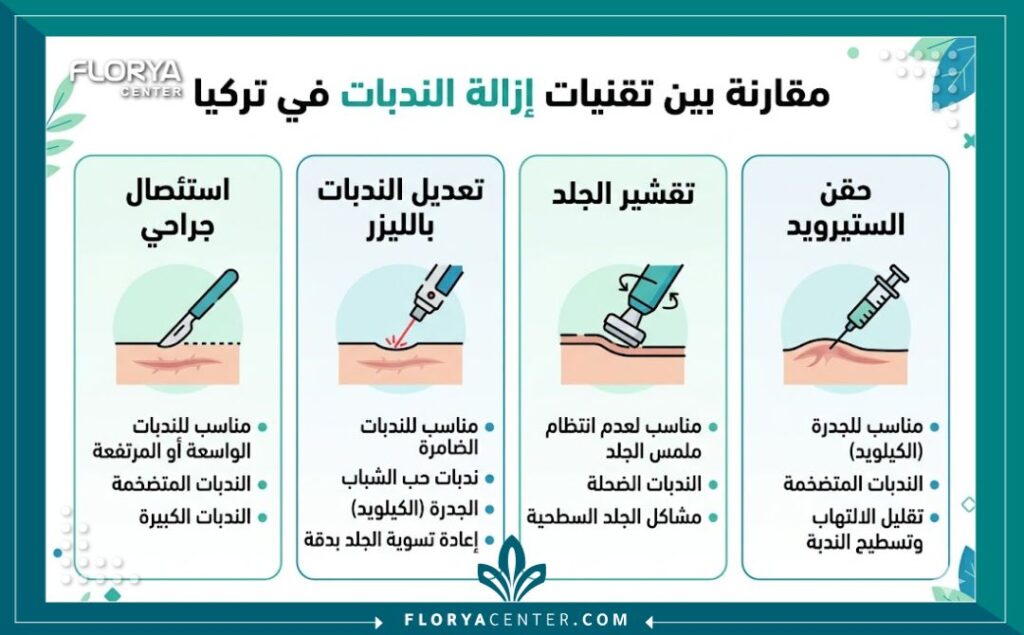 انفوجرافيك يقارن بين تقنيات جراحة إزالة الندبات الأربعة الرئيسية في تركيا: الاستئصال الجراحي، الليزر، تقشير الجلد، وحقن الستيرويد، مع شرح بالعربية.