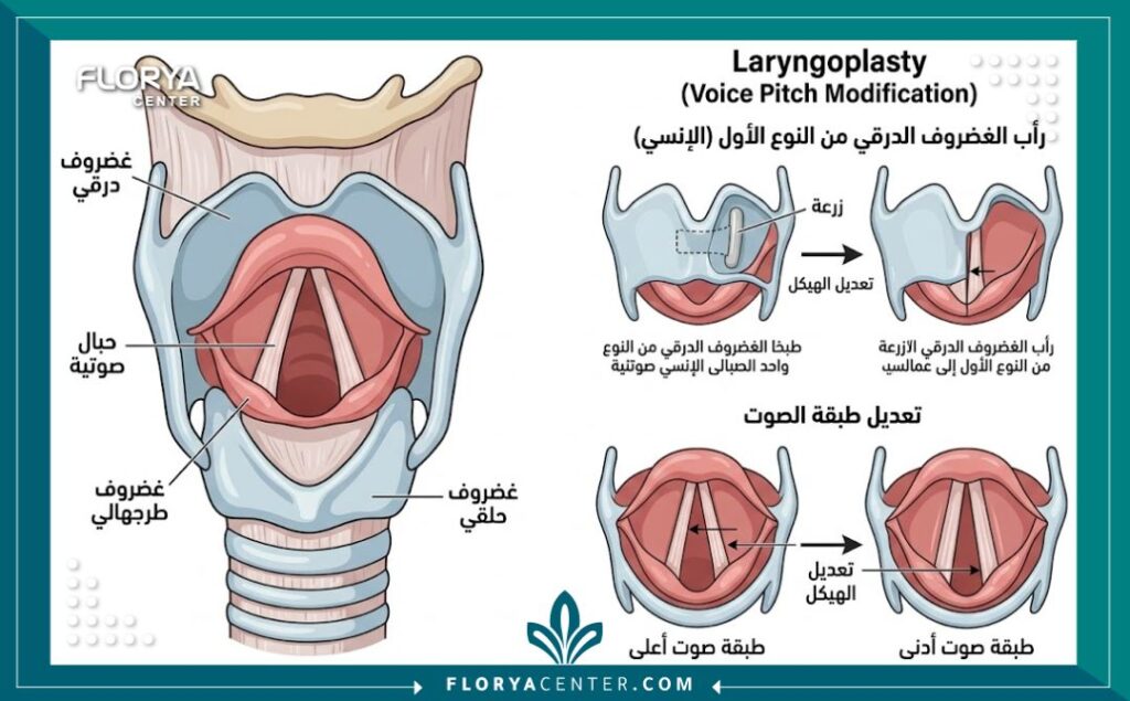 رسم تخطيطي طبي يوضح تشريح الحنجرة وكيفية تعديل الهيكل الخارجي لتغيير الصوت.