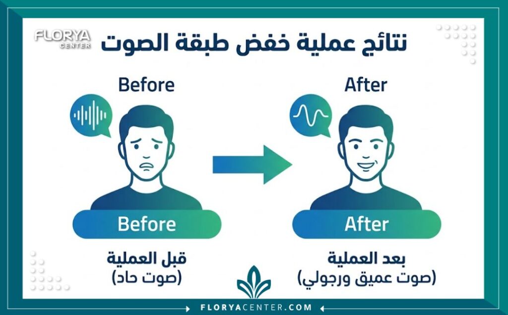 إنفوجرافيك يوضح مقارنة بين النتائج قبل وبعد جراحة خفض طبقة الصوت في تركيا.