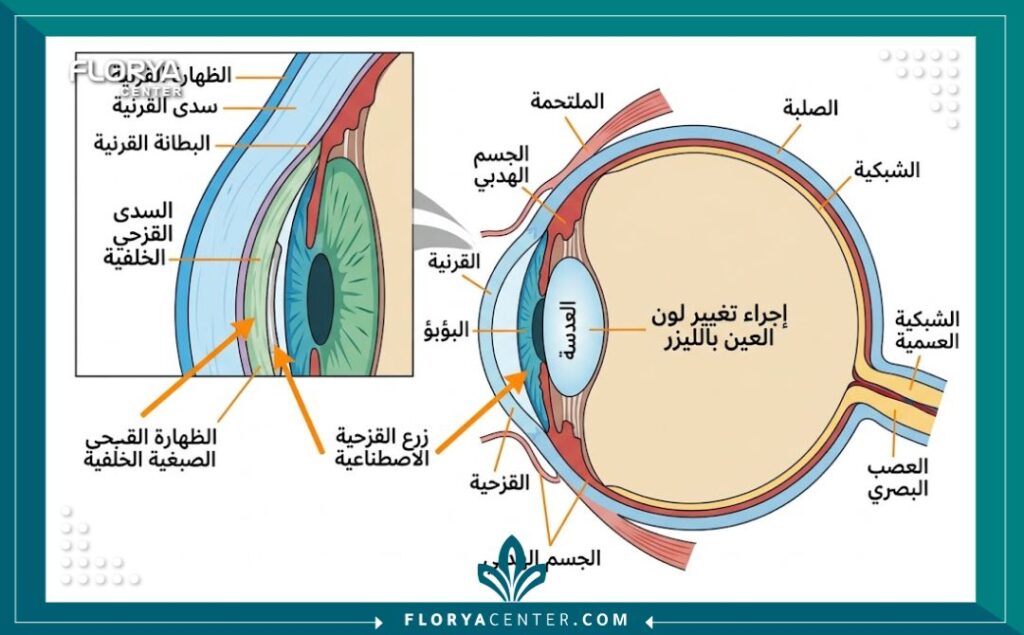 رسم تخطيطي طبي يوضح تشريح العين والمناطق المستهدفة في عملية تغيير لون القزحية في تركيا.