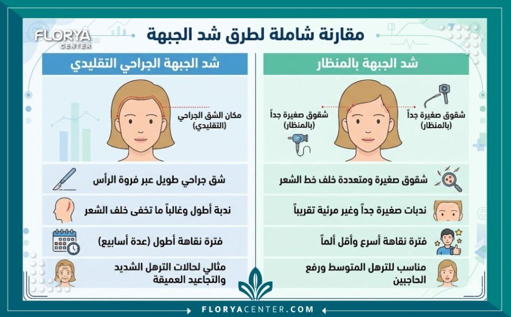إنفوجرافيك للمقارنة بين شد الجبهة الجراحي التقليدي (Coronal Lift) وشد الجبهة بالمنظار (Endoscopic Lift) من حيث الشقوق والنتائج.