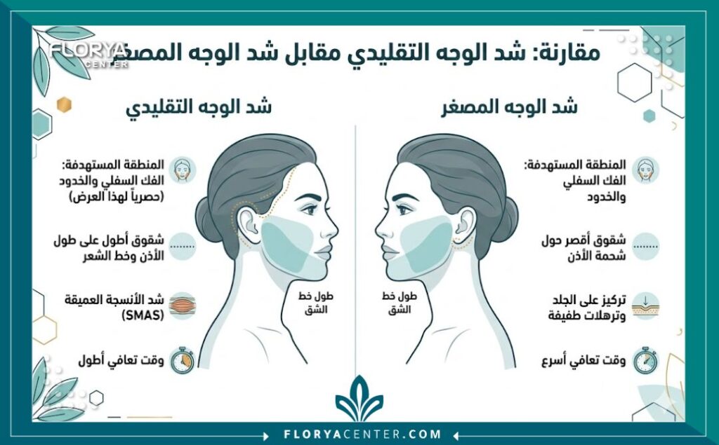 شد الوجه المصغر جراحياً في تركيا 3 إنفوجرافيك مقارنة يوضح الفرق بين شد الوجه التقليدي وشد الوجه المصغر من حيث فترة التعافي ومكان الشق الجراحي.