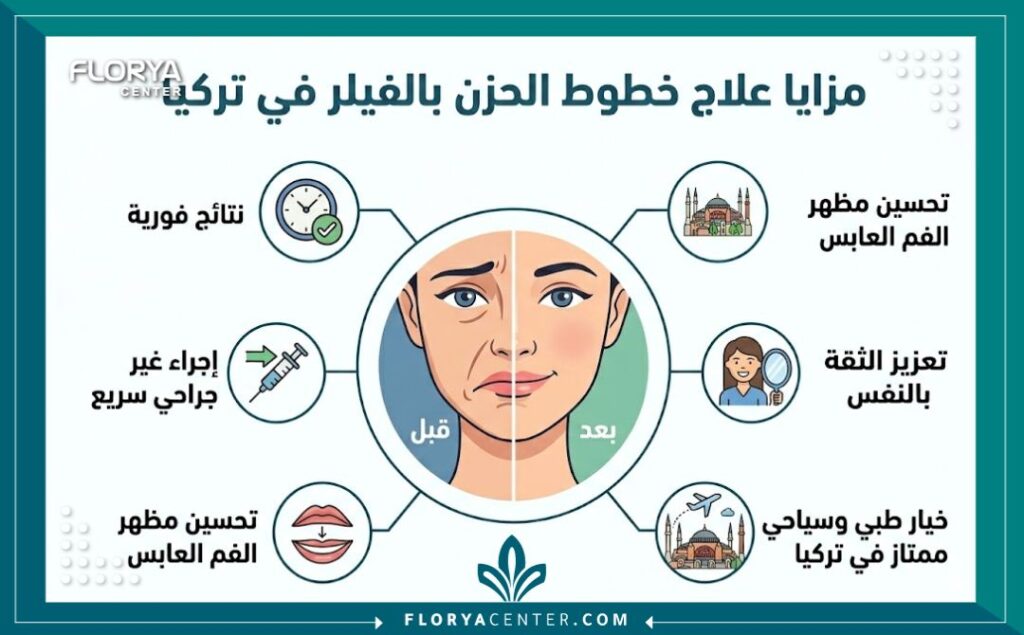 إنفوجرافيك يوضح فوائد علاج خطوط الحزن حول الفم بالفيلر في تركيا، بما في ذلك النتائج الفورية وتحسين المظهر دون جراحة.