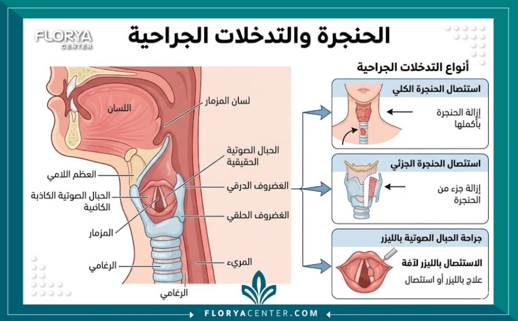 رسم توضيحي طبي لتشريح الحنجرة والأحبال الصوتية في الرقبة، يوضح الهياكل المستهدفة في عمليات تجميل الصوت في تركيا.