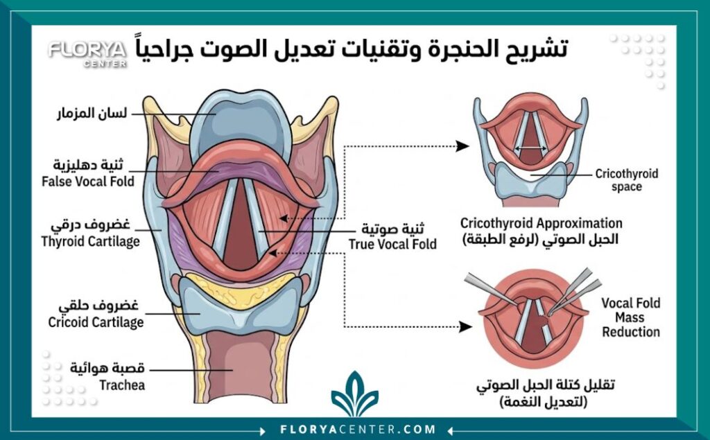رسم توضيحي طبي لتشريح الحنجرة يبين كيفية تعديل طول وكتلة وشد الاحبال الصوتية جراحياً
