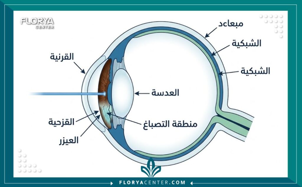 رسم تخطيطي طبي يوضح تشريح العين وآلية عمل الليزر في تغيير لون القزحية، مع تسميات باللغة العربية لشرح العملية الطبية.