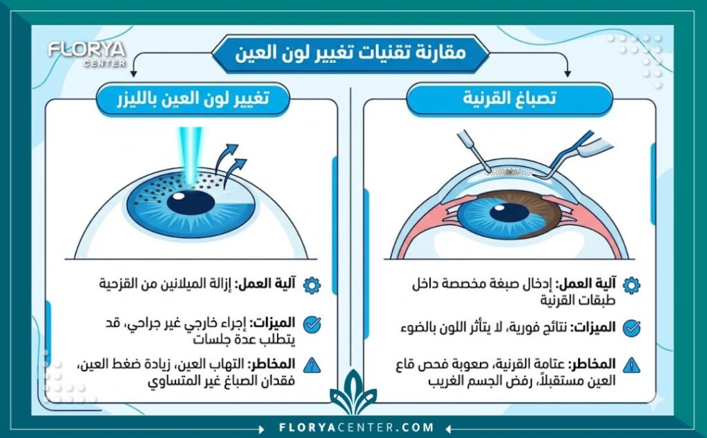 إنفوجرافيك يقارن بين تقنيتين لتغيير لون العين: تقنية الليزر (تصبغ القزحية) وتقنية تصبغ القرنية، مع توضيح مبسط لكل طريقة باللغة العربية.