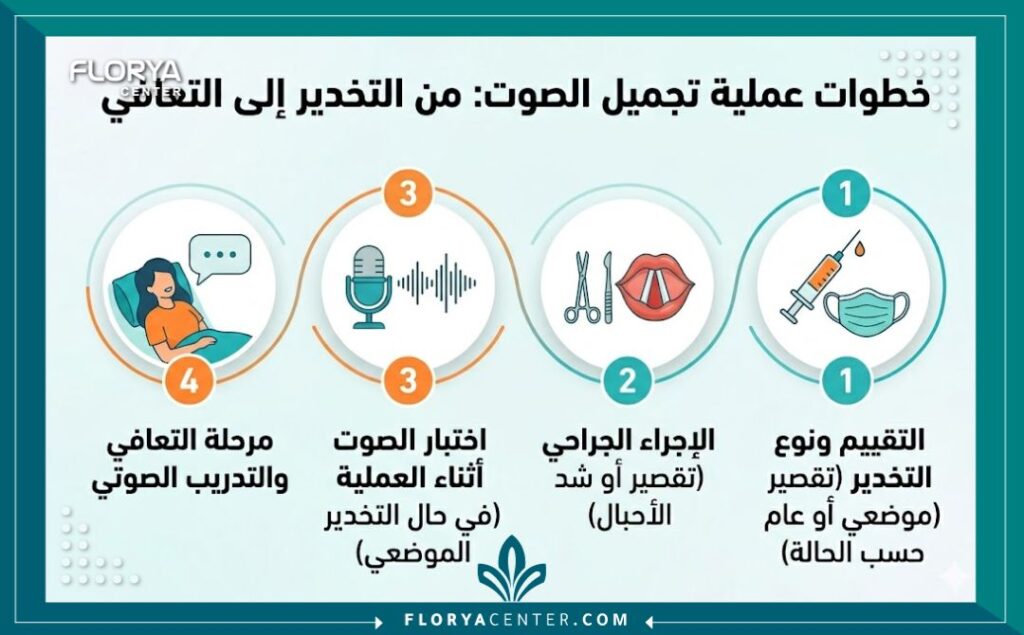 إنفوجرافيك يوضح خطوات كيف تتم عملية تجميل الصوت الأربعة: التقييم والتخدير، الإجراء الجراحي، اختبار الصوت أثناء العملية، ومرحلة التعافي، مع أيقونات توضيحية ونصوص عربية.