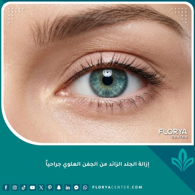 صورة مقربة لعين جذابة تظهر النتائج الطبيعية بعد إزالة الجلد الزائد من الجفن العلوي جراحياً لمظهر أكثر شباباً.