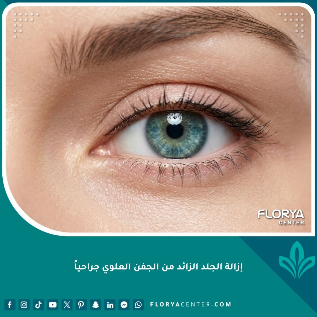 صورة مقربة لعين جذابة تظهر النتائج الطبيعية بعد إزالة الجلد الزائد من الجفن العلوي جراحياً لمظهر أكثر شباباً.