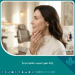 صورة مقربة لامرأة تبرز خط فكها المحدد بوضوح بعد عملية إزالة دهون الجيوب الفكية جراحياً.