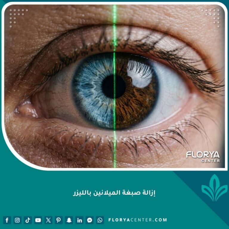 صورة مقربة سينمائية تظهر نتائج إزالة صبغة الميلانين بالليزر من العين، مقارنة بين العين البنية قبل والعين الزرقاء بعد العملية.