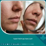صورة مقربة لوجه امرأة تتفحص منطقة تحت الأنف، تعكس القلق من اضرار عملية رفع الشفة العلوية وتأثيرها.