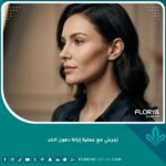 نتيجة مثالية لعملية إزالة دهون الخد تظهر وجهًا منحوتًا ومحدَّدًا لامرأة في مقتبل العمر، مما ينفي شائعات الشيخوخة المبكرة.