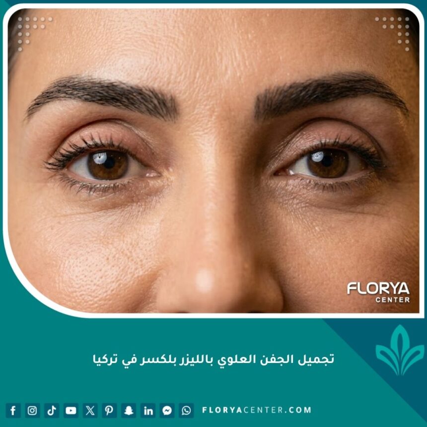 نتيجة نهائية مذهلة لعملية تجميل الجفن العلوي بالليزر بلكسر في تركيا تظهر عيوناً شابة ومفتوحة.