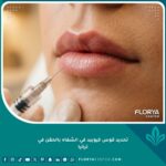 صورة مقربة سينمائية لنتائج تحديد قوس كيوبيد في الشفاه بالفيلر بشكل طبيعي وجذاب في عيادة تجميل بتركيا.