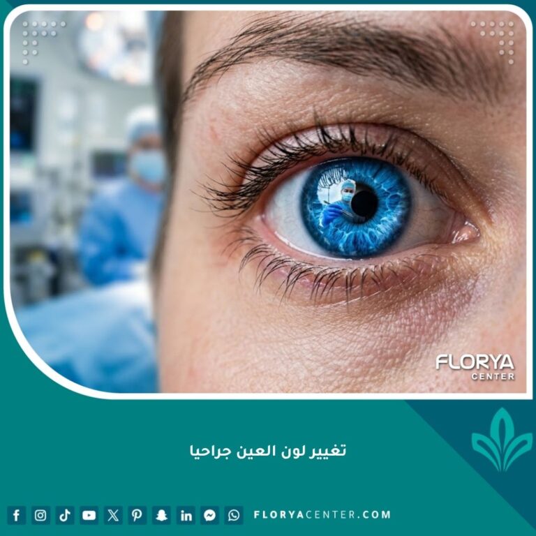 عملية تغيير لون العين جراحيا باستخدام زرع قزحية صناعية، لقطة مقربة لعين ذات لون جديد.