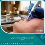 لقطة مقربة سينمائية دقيقة لجهاز ديرمابن أثناء تطبيق الكوكتيل الإسباني الميزوثيرابي على البشرة في عيادة تجميل راقية في إسطنبول، تركيا.