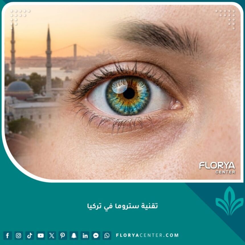 لقطة سينمائية قريبة لعين تخضع لعملية تغيير اللون بتقنية ستروما في تركيا، تظهر تدرج الألوان في القزحية مع خلفية لمدينة إسطنبول.