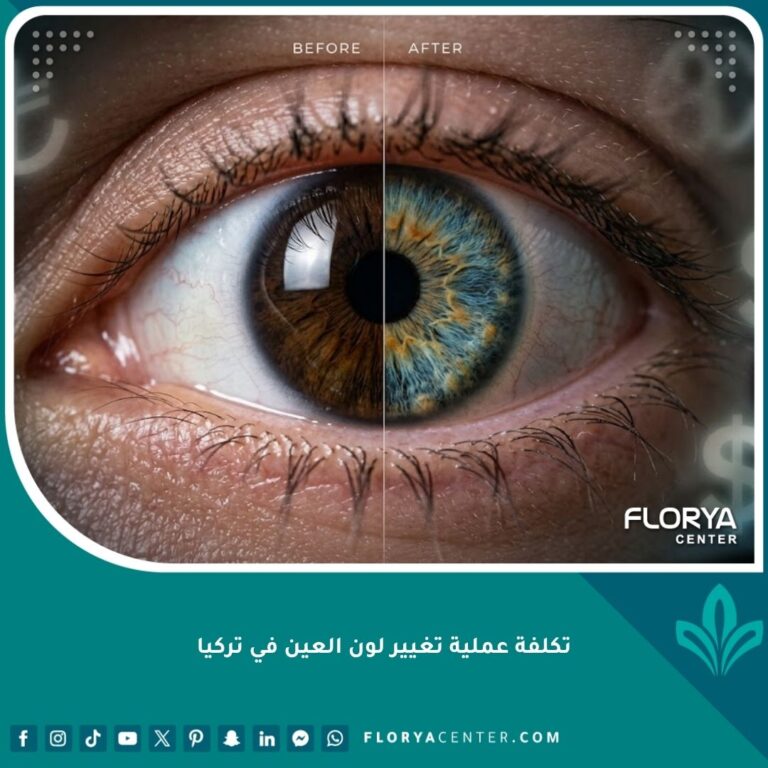 صورة سينمائية مقربة توضح تغيير لون العين قبل وبعد واللمعان الناتج عن العملية في تركيا.