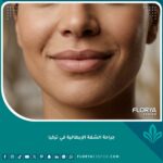 نتيجة طبيعية وجذابة لجراحة الشفة الإيطالية في تركيا لإبراز جمال الفم.