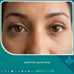 صورة مقربة تظهر جمال وتماثل العينين بعد نجاح جراحة تصحيح ارتخاء الجفن واستعادة الرؤية.
