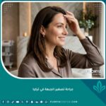 امرأة جميلة تبتسم بثقة وتلمس جبهتها المتناسقة بعد نجاح جراحة تصغير الجبهة في تركيا.