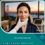 امرأة ذات بشرة نضرة وشابة بعد إجراء حقن الخلايا الليفية في تركيا، مع إطلالة على البوسفور في الخلفية.