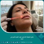 صورة سينمائية مقربة تظهر سيدة تخضع لعلاج خطوط التدخين حول الفم بالليزر في عيادة تجميل راقية في تركيا، مع بشرة مشدودة وناعمة فوق الشفة العليا.