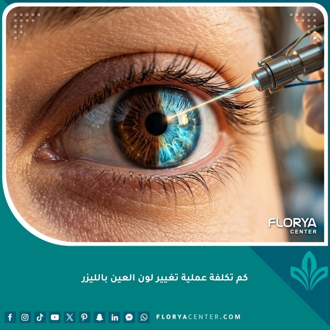 صورة سينمائية قريبة تظهر عملية تحول لون العين من البني إلى الأزرق الفاتح باستخدام تقنية تفتيت الميلانين بالليزر، تبرز جمالية النتيجة قبل وبعد.