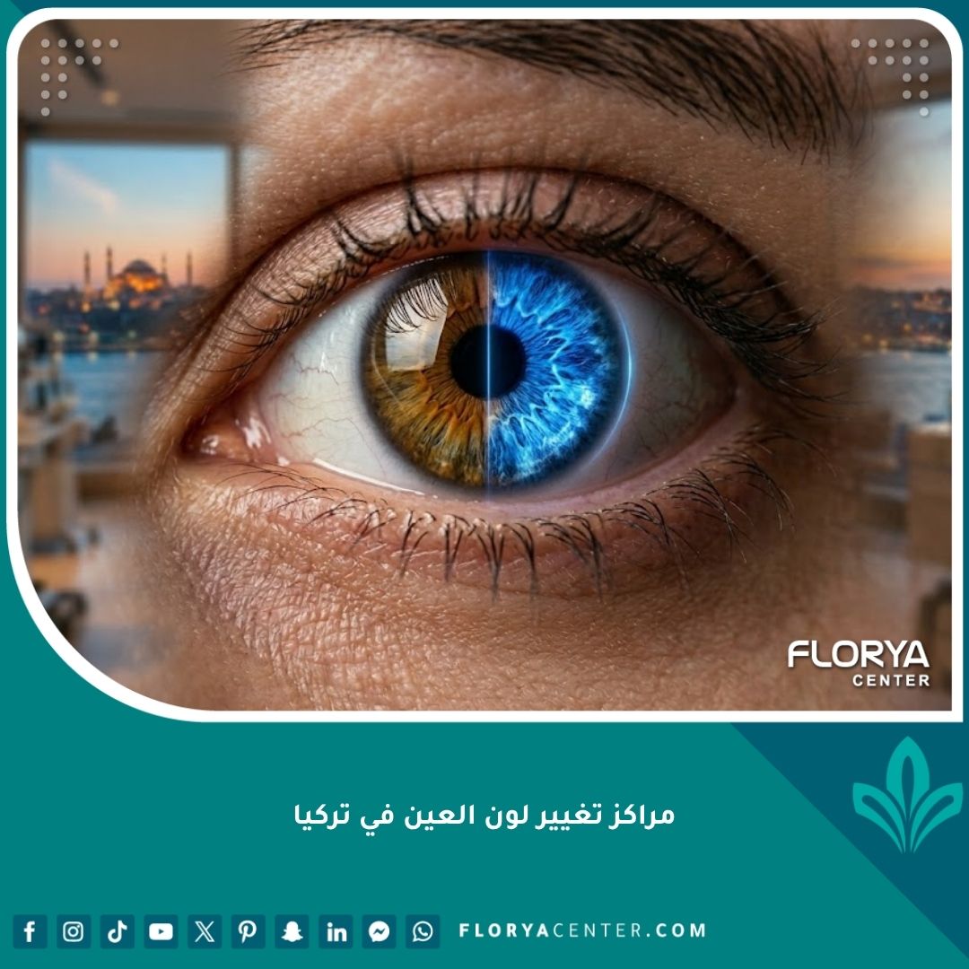 صورة سينمائية مقربة لعملية تغيير لون العين في مركز طبي فاخر في تركيا، تظهر تحول قزحية العين من العسلي إلى الأزرق مع إطلالة على إسطنبول.