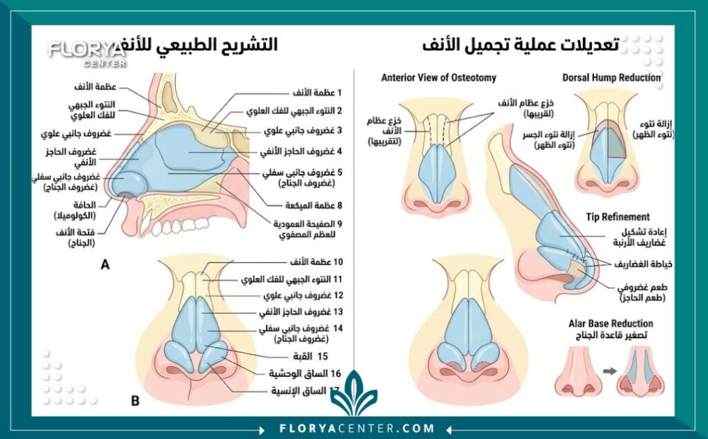 مخطط طبي يوضح تشريح الأنف والمناطق المستهدفة في عملية تصغير الأنف.