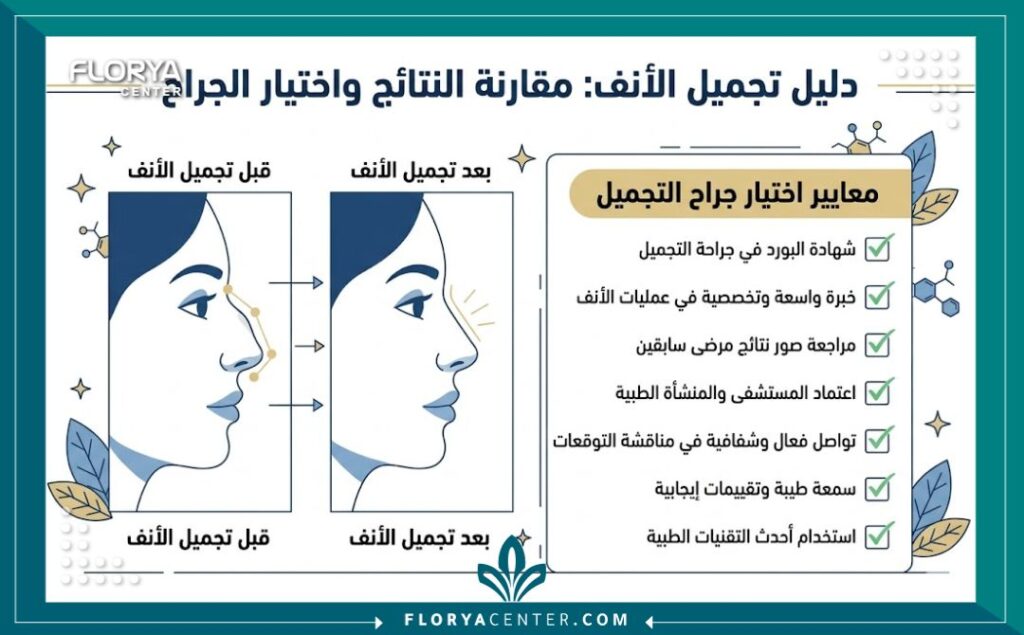 إنفوجرافيك معايير اختيار أحسن دكتور لتجميل الأنف في تركيا وصور قبل وبعد