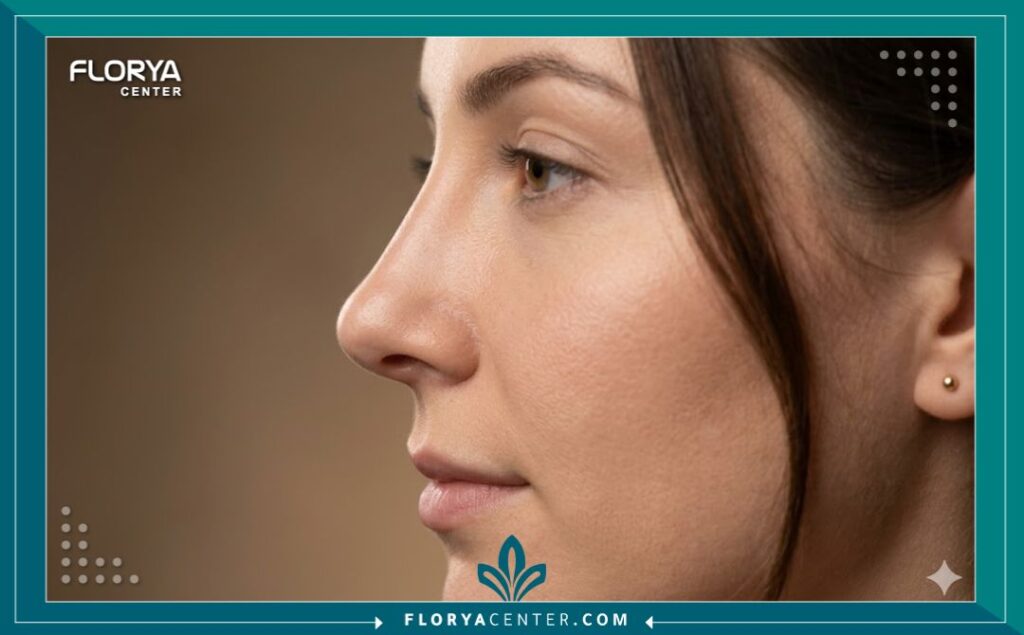 نتيجة طبيعية واحترافية لعملية تجميل أنف ناجحة على يد أمهر جراحي التجميل