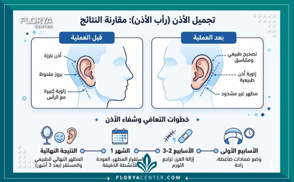أفضل جراح تجميل أذن في تركيا 3 إنفوجرافيك يوضح الفرق قبل وبعد عملية تجميل الأذن ومراحل التعافي السليم مع أفضل جراح تجميل أذن في تركيا.